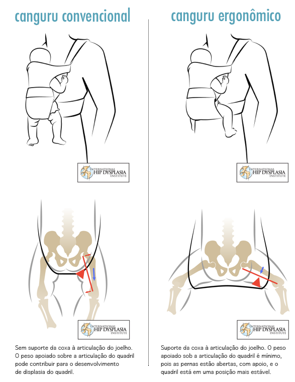 canguru-ergonomico